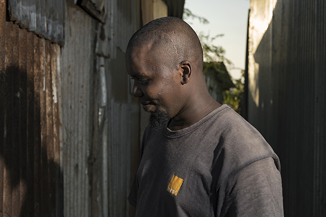 Although this young man, in an irregular situation, was lucky enough to be evacuated to a Metropolitan France hospital for complex brain surgery, he was unable to receive follow-up care on his return to Mayotte, due to a lack of a residence permit. Mayotte - 2021