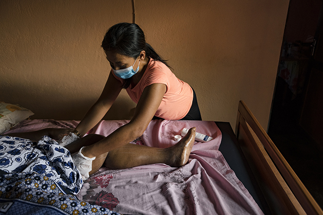 The massages given by Pauline, a physiotherapist in Mayotte, are essential for the daily comfort of this bedridden and isolated woman. Mayotte - 2021