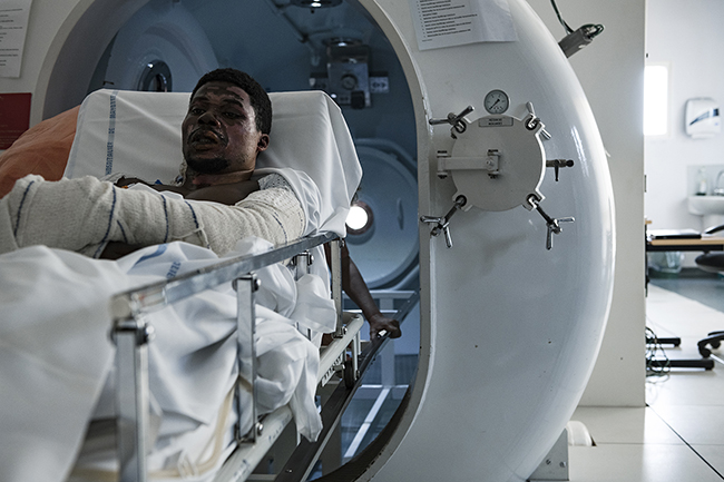 Originally used to treat decompression sickness during diving, the hyperbaric chamber is used at the Centre Hospitalier de Mayotte (CHM) in Mamoudzou to help the healing of burnt tissues. Mayotte - 2021