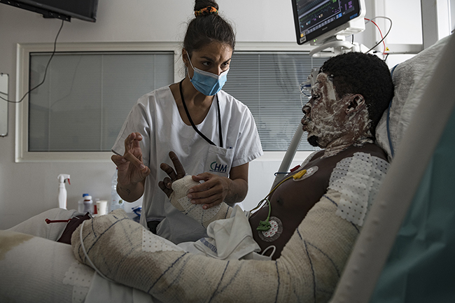 Rehabilitation session for this burn victim who came out of an artificial coma in the intensive care unit of the Centre Hospitalier de Mayotte (CHM). Mayotte - 2021